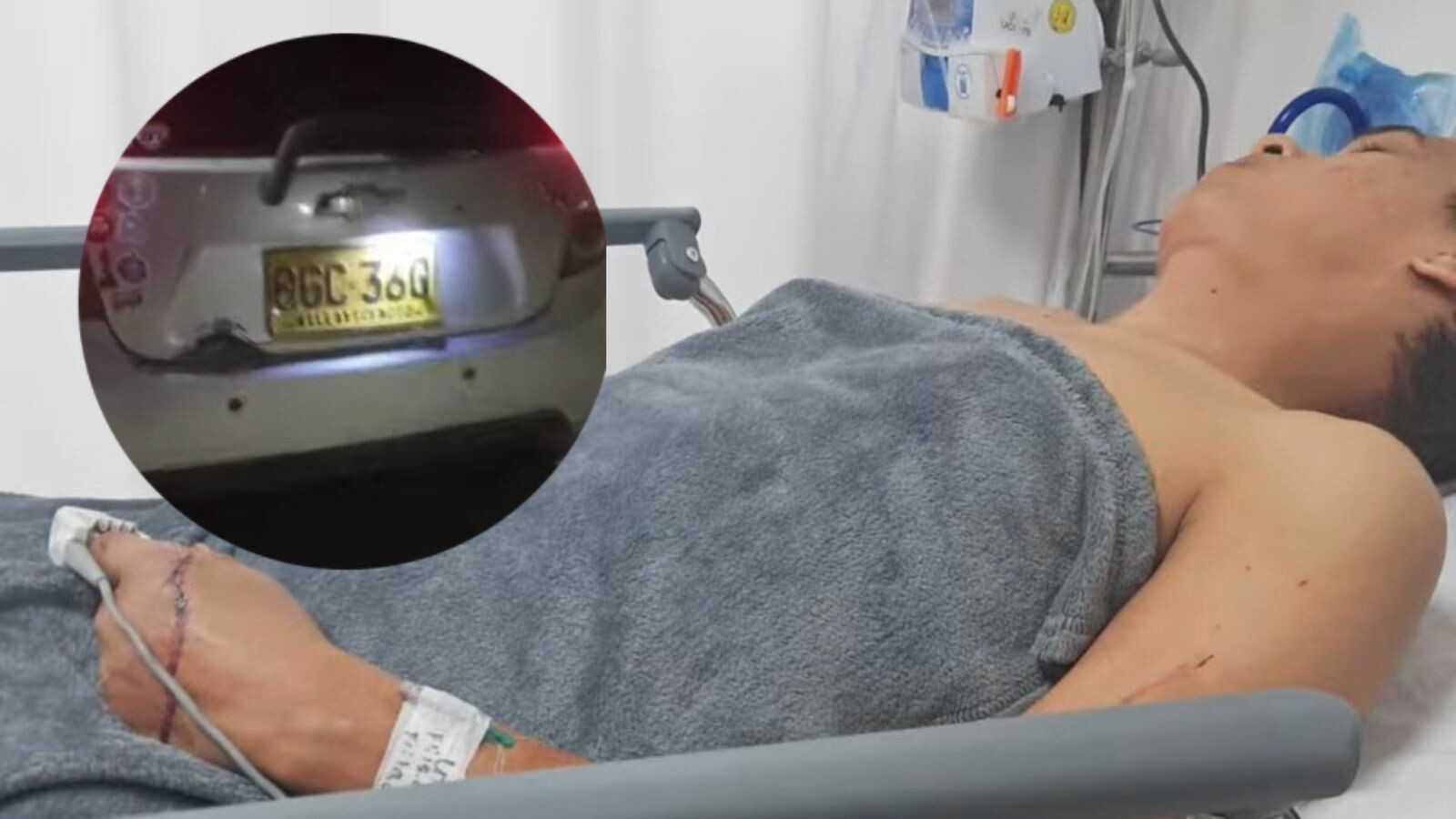 Ataques a conductores de plataformas dejan herido grave en Ibagué