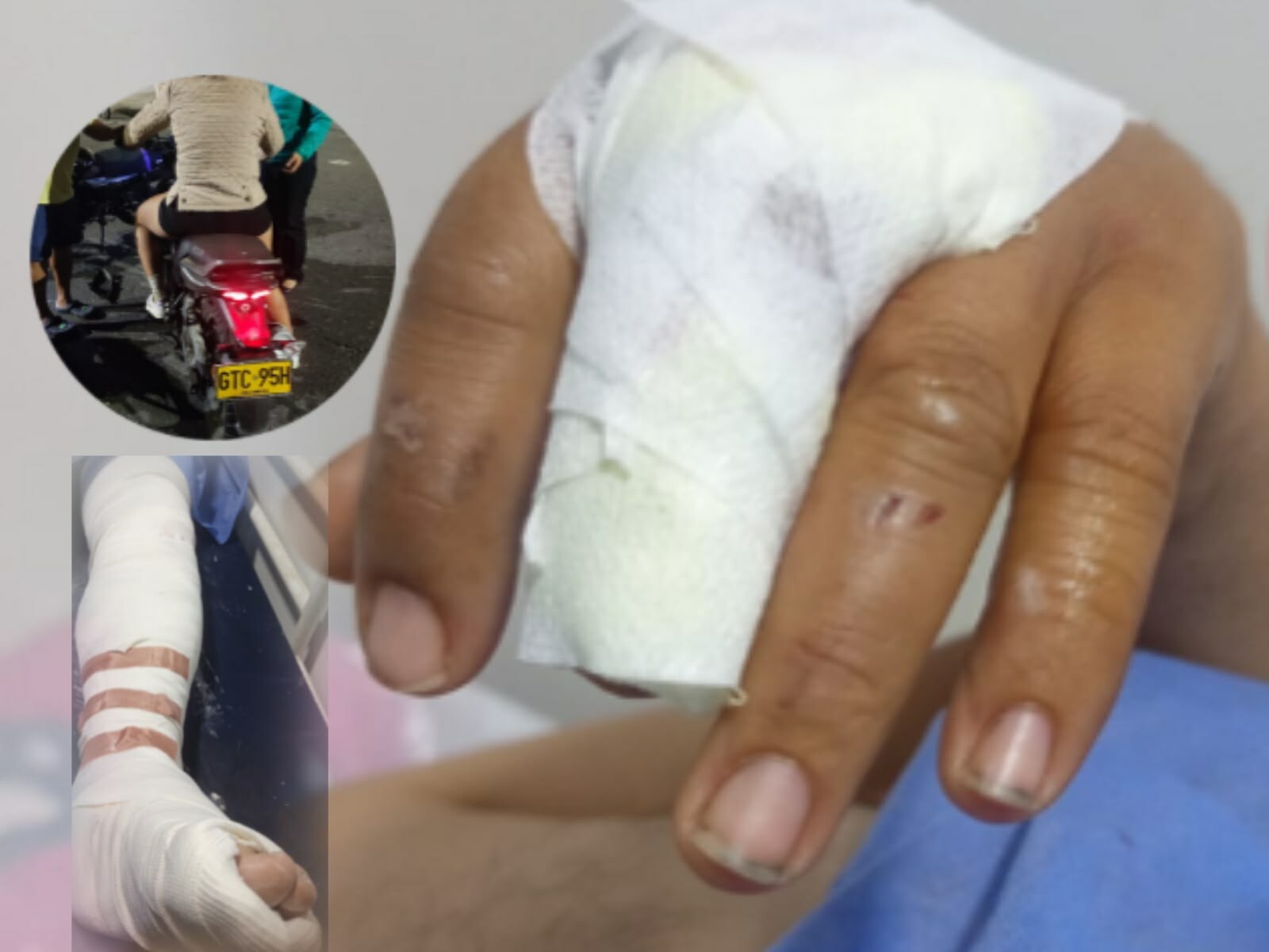 Buscan motociclista tras accidente que dejó un hombre gravemente herido