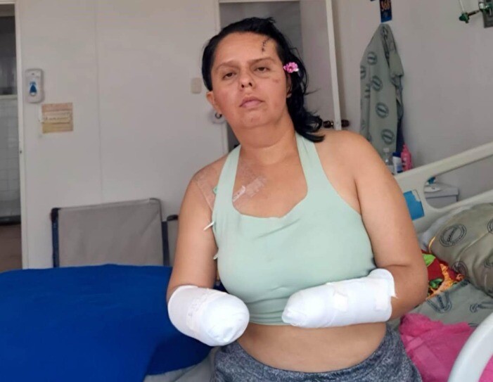 Las amenazas terminaron en un ataque que cambió su vida